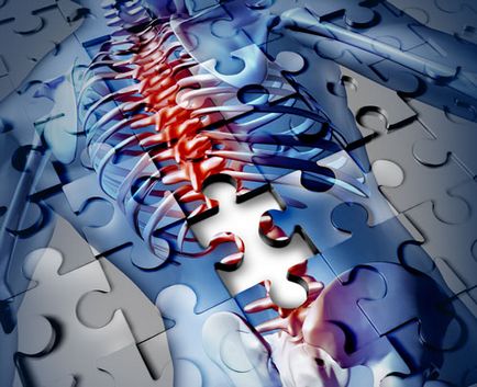 Hemangiomul coloanei vertebrale - simptome, cauze de apariție, tratament