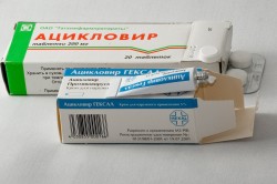 Herpes tünetek az újszülött, a kezelés és következményei (fotó és videó) (kezelés) Herpes tünetek az újszülött, és a kezelés hatásai (fotók és videó)