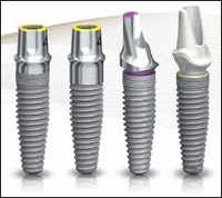 Implanturile nobile înlocuiesc avantajele implanturilor, instalarea