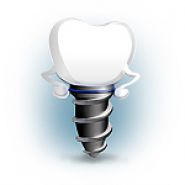 Az implantátumok nemes helyettesítheti a méltóságot implantátum beillesztése (helyett) Az implantátumok nemes helyettesítheti a méltóságot implantátumok telepítés