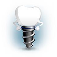 Implanturile nobile înlocuiesc avantajele implanturilor, instalarea