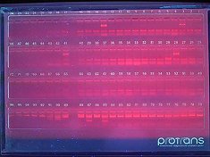 Institutul de Hematologie și Transplantologie Pediatrică