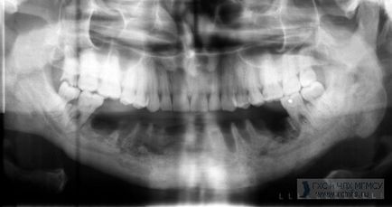 Departamentul de Chirurgie Maxilofacială mgmsu