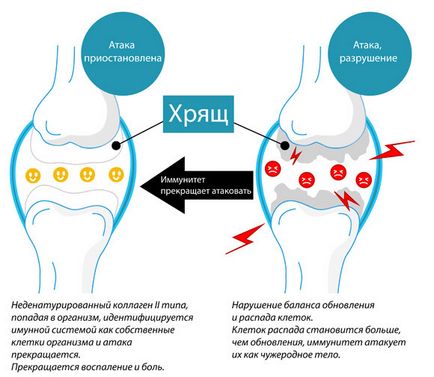 Як лікувати суглоби за допомогою курячого хряща