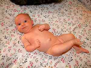 Як вилікувати пупкову грижу у немовляти - хвороби м'язової системи - каталог статей -