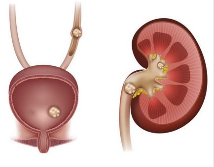 Cum să eliminați sărurile alcaline din organism