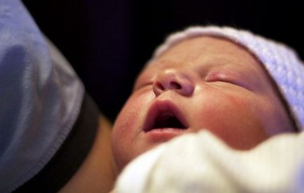 Кіста в голові у новонародженої дитини, як лікувати дитину