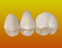 Коронки на зуби види, установка і фото