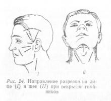 Лікування одонтогенних запальних захворювань, довідник лікаря