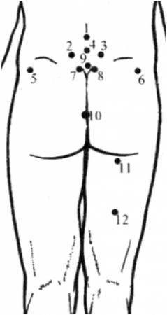 Tratamentul sciaticii cu lipitori - hirudoterapie - site medical