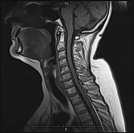 Imagistica prin rezonanță magnetică (MRT) pe un aparat modern de contur deschis în clinică - prima