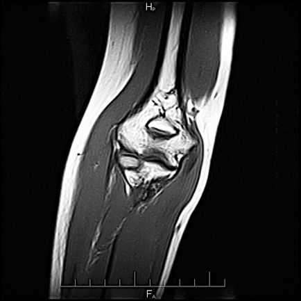 Imagistica prin rezonanță magnetică (MRT) pe un aparat modern de contur deschis în clinică - prima