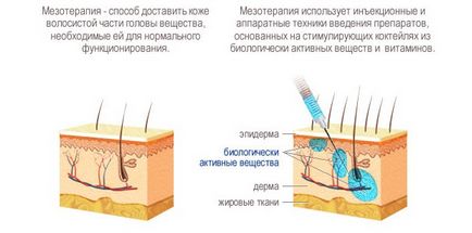 Mezoterápia a haj növekedési feje, mint az eljárást végzik, milyen hatása után