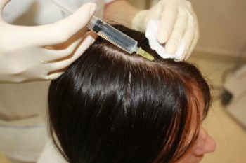 Mezoterapia pentru păr prezintă proceduri cosmetice, marturii și dovezi de eficacitate