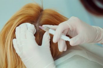 Mezoterapia pentru păr prezintă proceduri cosmetice, marturii și dovezi de eficacitate