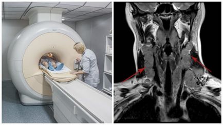 MRI a torok és a gége, amely bemutatja az eljárást, és hogyan kell felkészülni