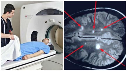 Domnul în caz de semne multiple de scleroză a bolii și diagnosticul acesteia