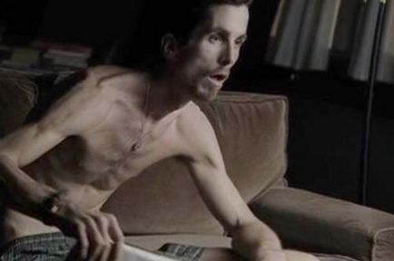 Men anorexia (étvágytalanság) Férfi anorexia