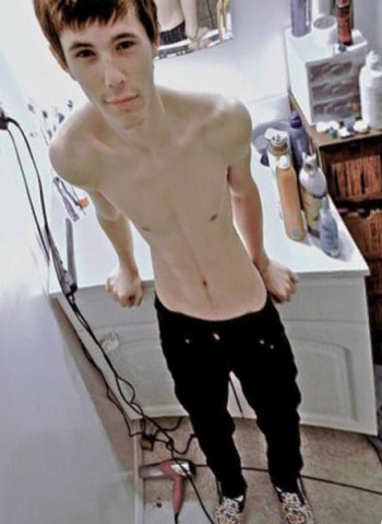 Férfi anorexia
