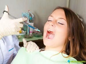 Чи потрібно приймати антибіотики після видалення зуба, можливі ускладнення при таких операціях
