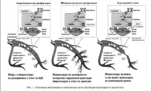 Caracteristicile atacurilor cu angină microvasculară