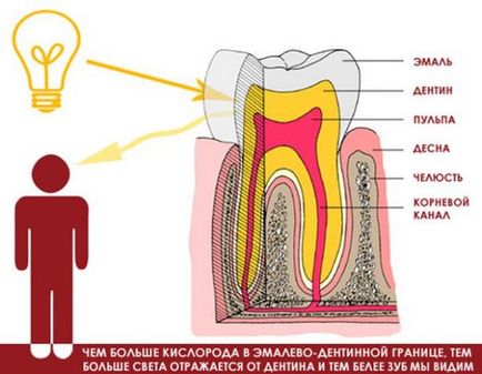 Відбілювання зубів yotuel - щадна прогресивна система