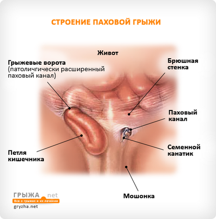 Пахова грижа симптоми і види