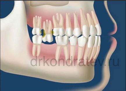 Переміщення зубів і деформації зубного ряду, доктор Кондратьєв