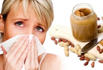 Alimentele alergice, cauzele apariției și soiurilor acestora