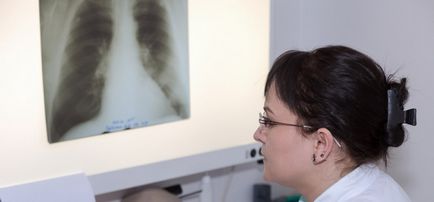 Indicatii pentru embolismul pulmonar cu contrast