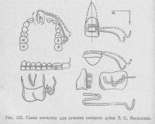 Turnuri de dinți în jurul axei longitudinale, stomatologie ortopedică