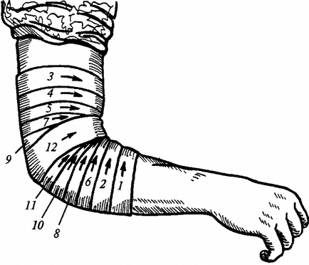 Bandaj pe articulația cotului (broaște țestoase, divergent și fixativ) pe bandaj elastic