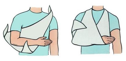Bandaj pe articulația articulației (broască țestoasă, divergentă și fixativă) pe bandaj elastic