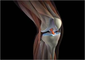 Причини і методи лікування болю в коліні, в тому числі з внутрішньої сторони і збоку