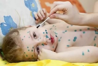 Vaccinarea împotriva revizuirilor copiilor variola
