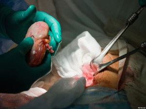 Proiect de lege privind transplantul de organe - medic idan znich