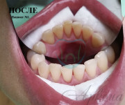 Igiena profesională - arcona dentistry