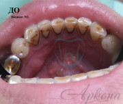 Igiena profesională - arcona dentistry