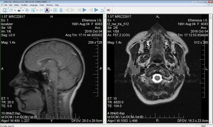 Program megtekintésére MRI felvételek