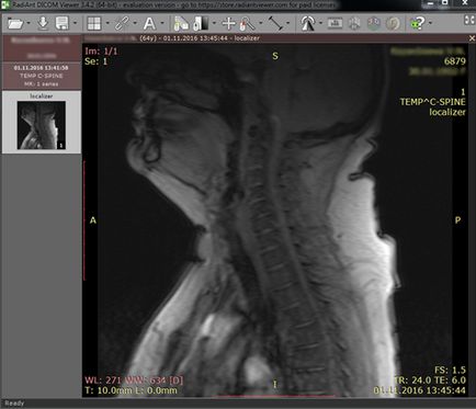 Program megtekintésére MRI felvételek