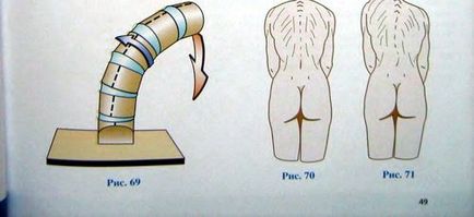 Rotirea coloanei vertebrale cu laterofleksii, totul despre coloana vertebrală