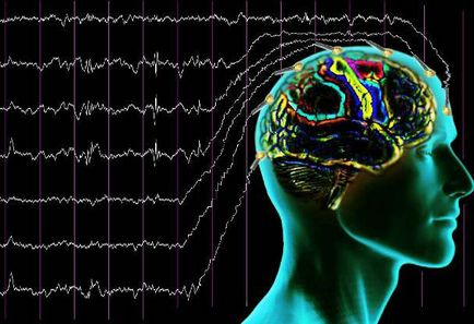 Efectuați o electroencefalogramă a creierului la un preț accesibil în g
