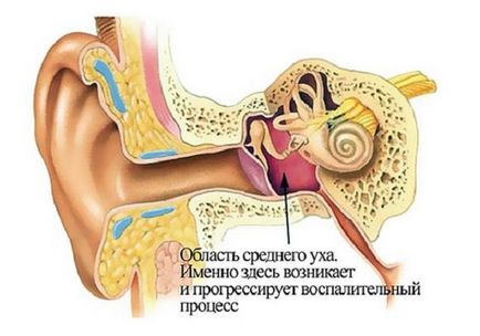 Шум у вухах і голові причини, що робити, засоби народної медицини