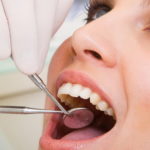 Din ce săptămână puteți trata dinții însărcinați