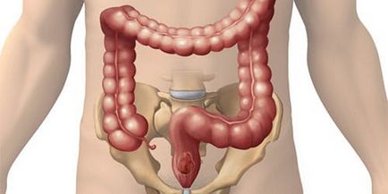 Dreaming intestine de a visa de intestine intr-un vis