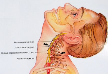 Сучасне лікування травми хлиста шиї - наслідки травми