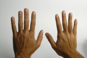 Tratament foarte eficient al durerii la falangele mâinilor