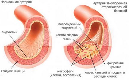 Forumul de informare și informare - portalul despre apeluri, vegetarianism și alimente crude