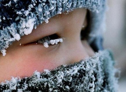 Холодова алергія симптоми, лікування, фото, ls