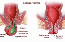 Жовчнокам'яна хвороба симптоми, лікування, дієта